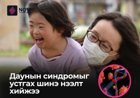 ДАУНЫ СИНДРОМЫГ ЭМЧЛЭХ БОЛОМЖТОЙ ШИНЭ НЭЭЛТ ХИЙЖЭЭ