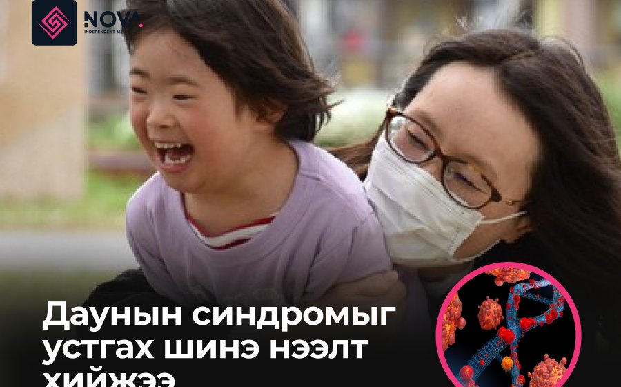 ДАУНЫ СИНДРОМЫГ ЭМЧЛЭХ БОЛОМЖТОЙ ШИНЭ НЭЭЛТ ХИЙЖЭЭ